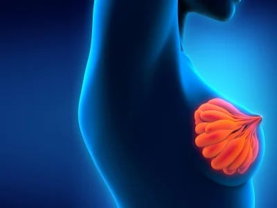 Autoaugmentation bei der Bruststraffung: Der Weg zu natürlicher Ästhetik ohne Implantate